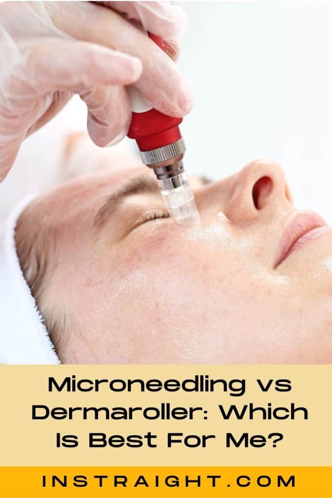 lady getting microneedling treatment